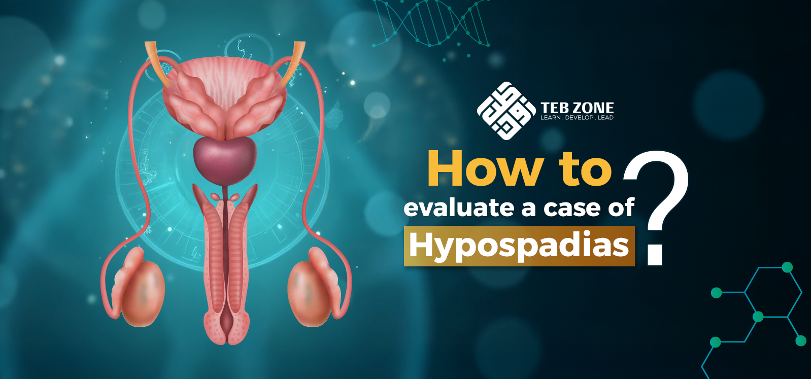 How to evaluate a case of hypospadias?